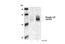 Phospho-LAT (Tyr191) Antibody