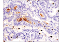 S100A9 (D5O6O) Rabbit mAb (IHC Formulated)