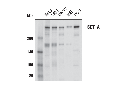SET1A (E3E2S) Rabbit mAb