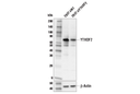 YTHDF2 (E2I2H) Rabbit Monoclonal Antibody