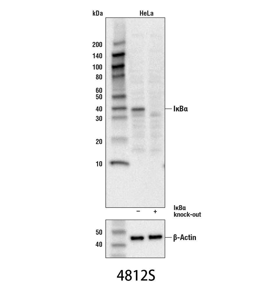 IκBα (44D4) Rabbit mAb