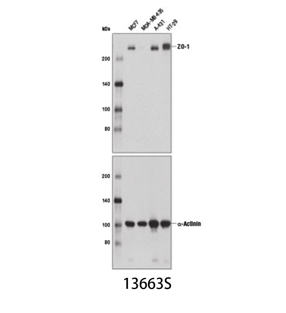 ZO-1 (D6L1E) Rabbit mAb