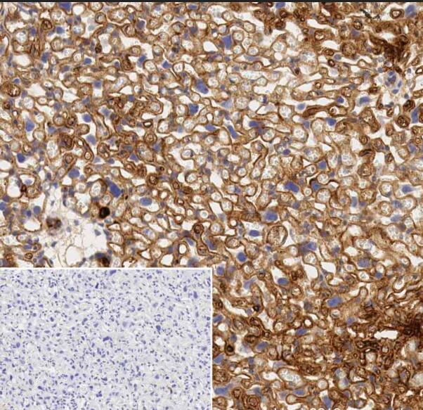 Anti-VEGFA antibody [VG-1]