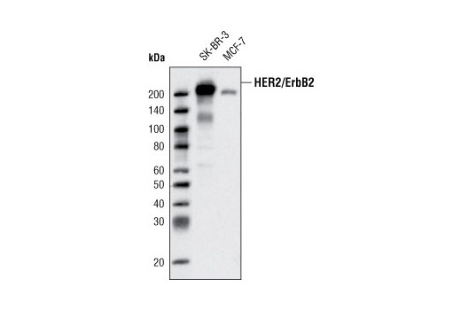 HER2/ErbB2 (D8F12) XP Rabbit mAb