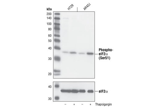 Phospho-eIF2α (Ser51) (119A11) Rabbit mAb