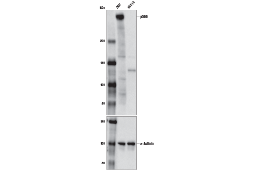 p300 (D2X6N) Rabbit mAb