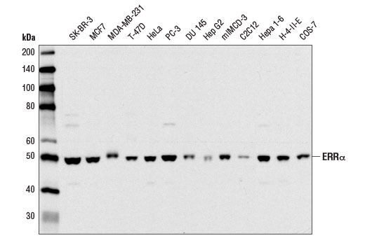 ERRα (E1G1J) Rabbit mAb