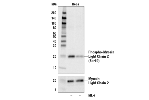 Phospho-Myosin Light Chain 2 (Ser19) Antibody