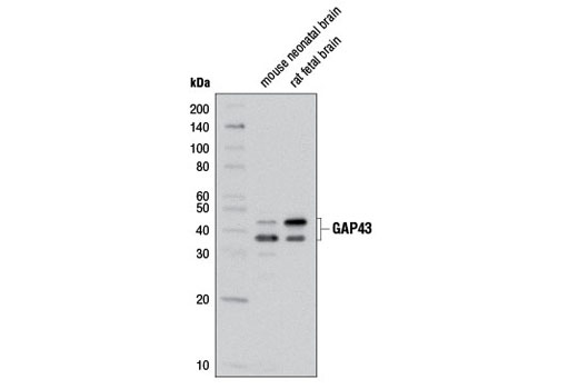 GAP43 (D9C8) Rabbit mAb