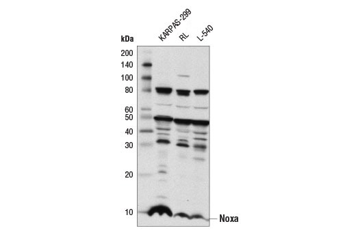 Noxa (D8L7U) Rabbit mAb