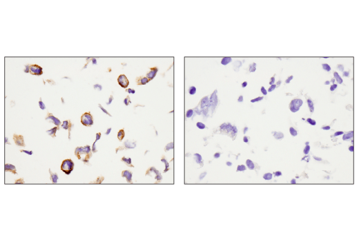 Podoplanin (LpMab-12) Mouse mAb
