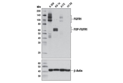 FGF Receptor 1 (D8E4) XPRabbit mAb