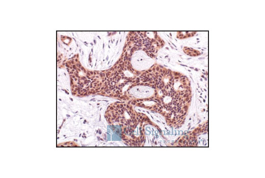 Phospho-Akt (Ser473) (736E11) Rabbit mAb