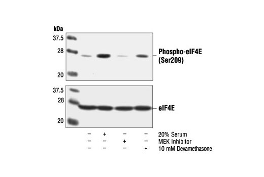 Phospho-eIF4E (Ser209) Antibody