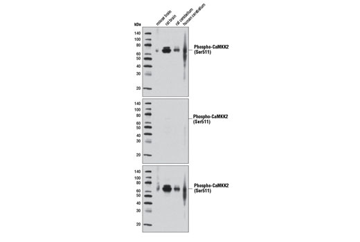 Phospho-CaMKK2 (Ser511) Antibody