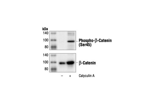 Phospho-β-Catenin (Ser45) Antibody