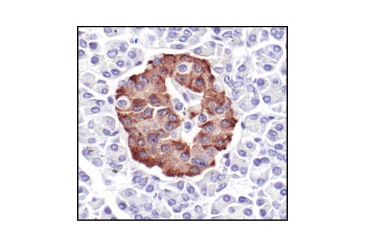 C-Peptide Antibody