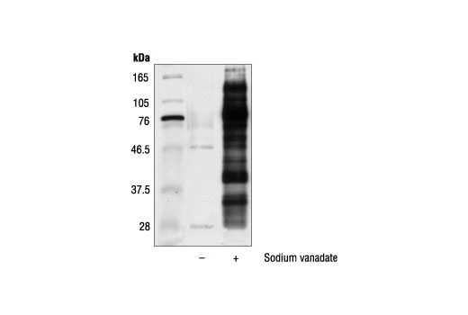 Phospho-Tyrosine Mouse mAb (P-Tyr-100) (SepharoseBead Conjugate)