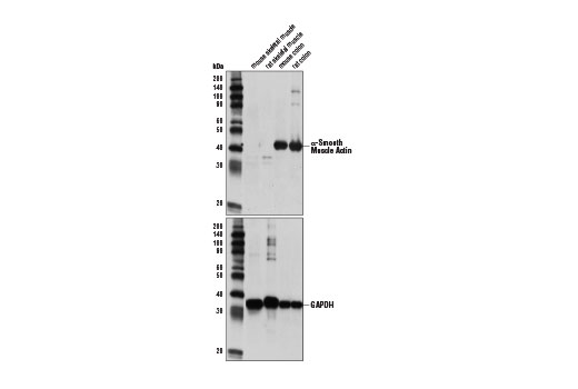 α-Smooth Muscle Actin Antibody