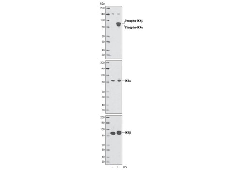 Phospho-IKKα (Ser176)/IKKβ (Ser177) (C84E11) Rabbit mAb
