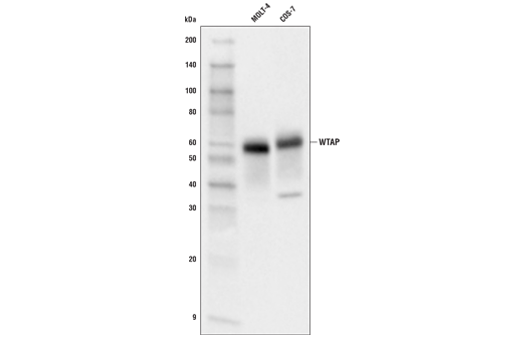 WTAP (E7O5B) Rabbit mAb