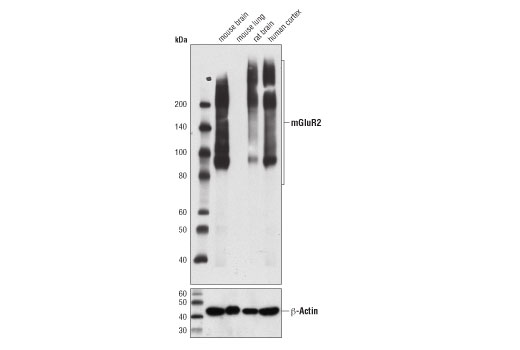 mGluR2 (D7D8M) Rabbit mAb