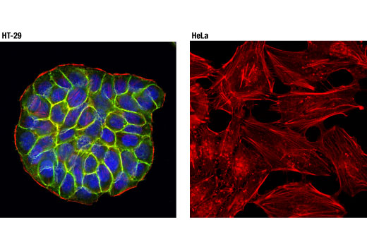 EpCAM (D4K8R) XP Rabbit mAb