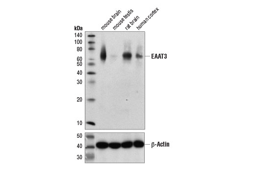 EAAT3 (E1E6M) Rabbit mAb
