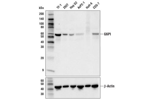 GPI Antibody