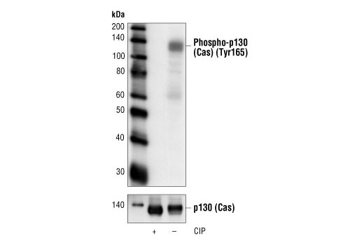 Phospho-p130 Cas (Tyr165) Antibody