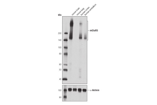 mGluR5 (D6E7B) Rabbit mAb
