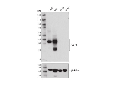 CD74 (D5N3I) XP Rabbit mAb
