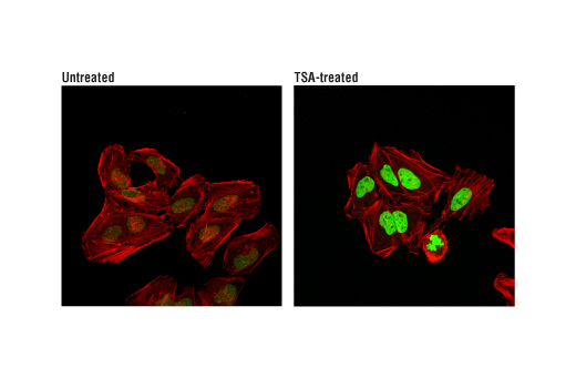 Acetyl-Histone H4 (Lys16) (E2B8W) Rabbit mAb (Alexa Fluor 488 Conjugate)