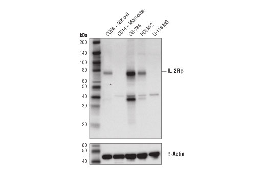IL-2Rβ (D4X3H) Rabbit mAb