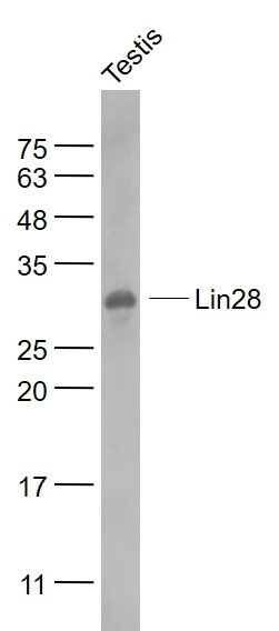 RNA结合蛋白LIN28抗体