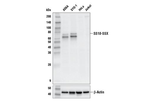 SS18-SSX (E9X9V) XP Rabbit mAb