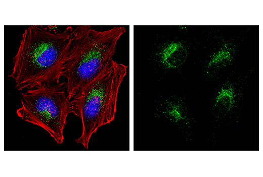 LAMP1 (D2D11) XP Rabbit mAb (Alexa Fluor 488 Conjugate)