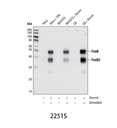 FosB (5G4) Rabbit mAb