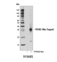 TREM2 (D8I4C) Rabbit mAb