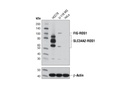 ROS1 (D4D6) Rabbit mAb