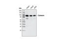 ER Stress Antibody Sampler Kit