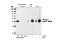 Phospho-p44/42 MAPK (Erk1/2) (Thr202/Tyr204) (20G11) Rabbit mAb