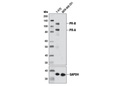 Progesterone Receptor A/B (D8Q2J) XP Rabbit mAb