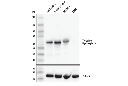 Tyrosine Hydroxylase (E2L6M) Rabbit mAb