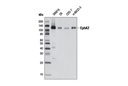 EphA2 (D4A2) XP Rabbit mAb