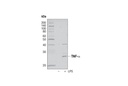 TNF-α Antibody