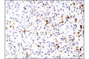 EGF Receptor vIII (D6T2Q) XP Rabbit mAb