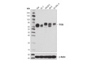 TFEB (D2O7D) Rabbit mAb