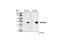 GST (91G1) Rabbit mAb