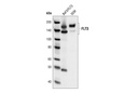 FLT3 (8F2) Rabbit mAb